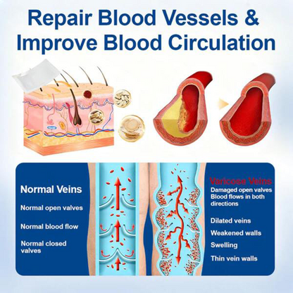 👨‍⚕️✅✅VeinTarget Microneedle Patch⚡Instant Relief, Long-Term Results