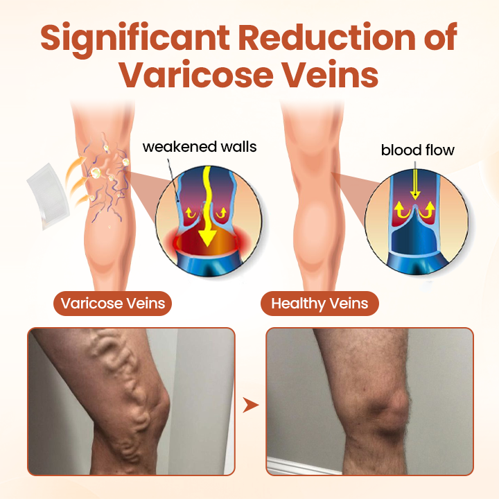 VeinTarget Microneedle Patch