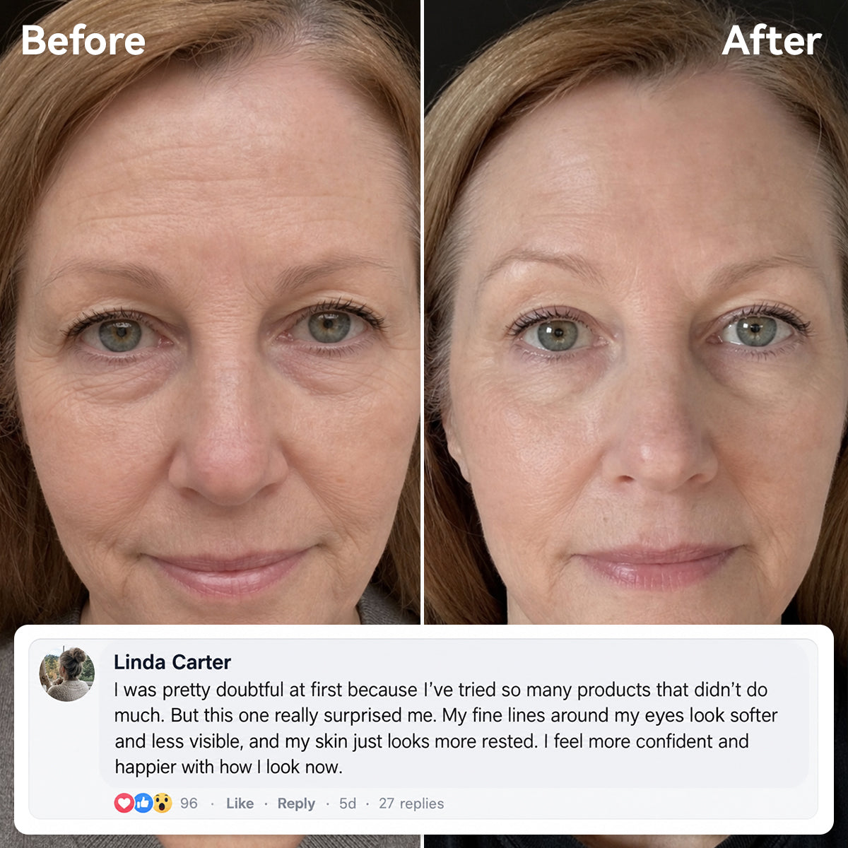 Line Smoother Perfect Skin in 3 Minutes