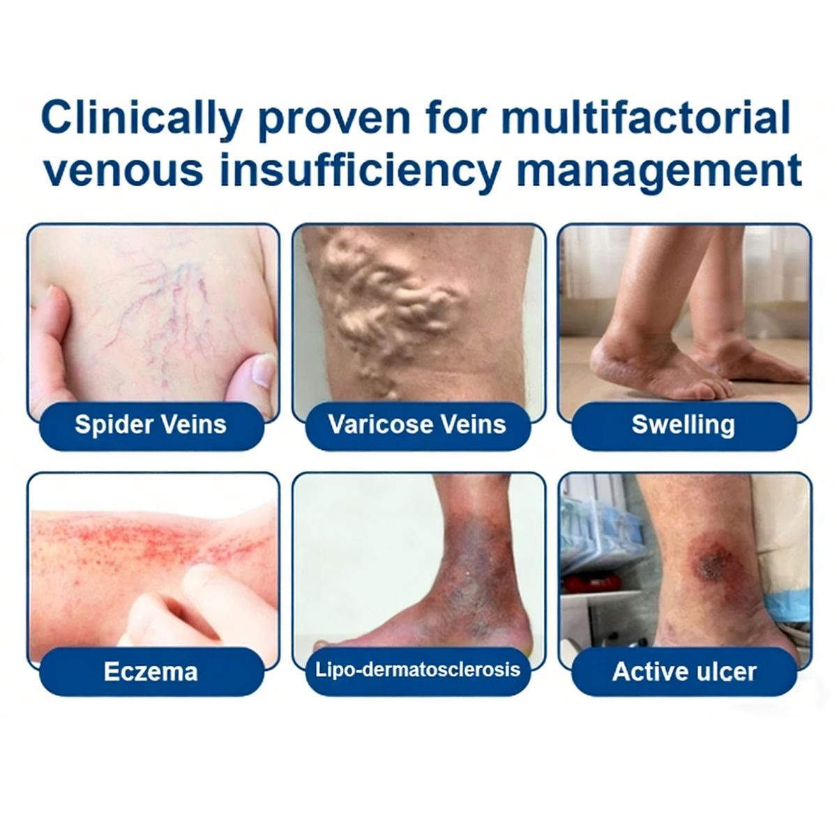Vein ContourMicroneedle Patch with AdvancedDiosmin & Hesperidin Delivery 🌿 7-Day Visible Results for VaricoseVeins
