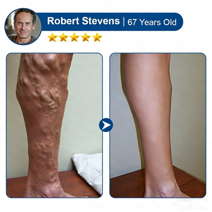 Vein ContourMicroneedle Patch with AdvancedDiosmin & Hesperidin Delivery 🌿 7-Day Visible Results for VaricoseVeins