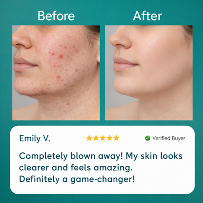 Tiktrove™ Hormonal Hair Remover PRO