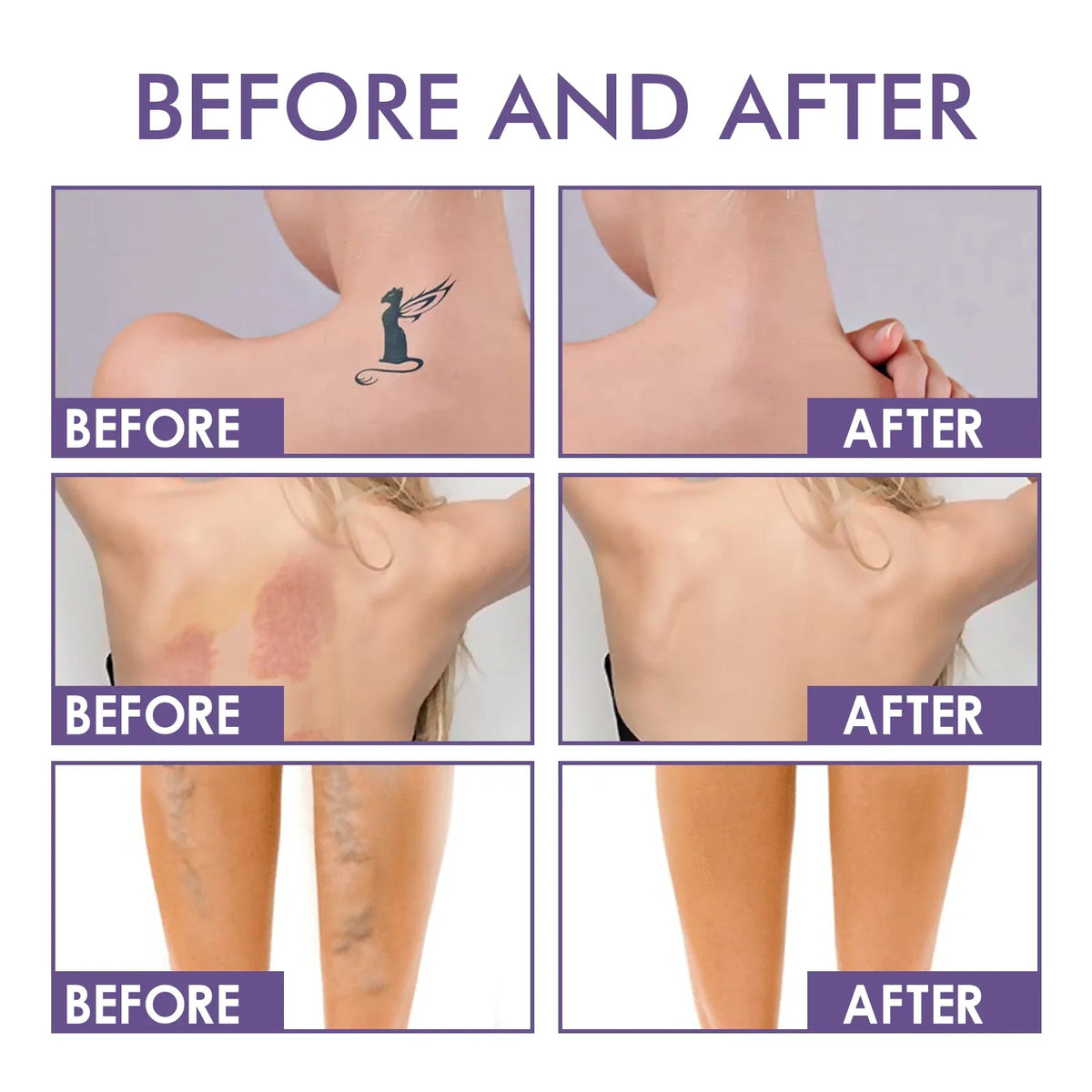 Body Perfector