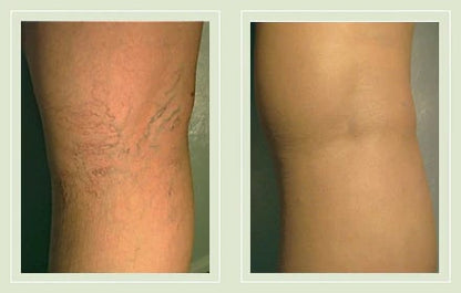 🔥2026 1-Second Airbrushed Leg Concealer🦵