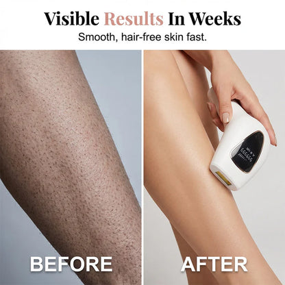 🔥LAST DAY 70%OFF🔥 Painless Hair Removal Device for Women