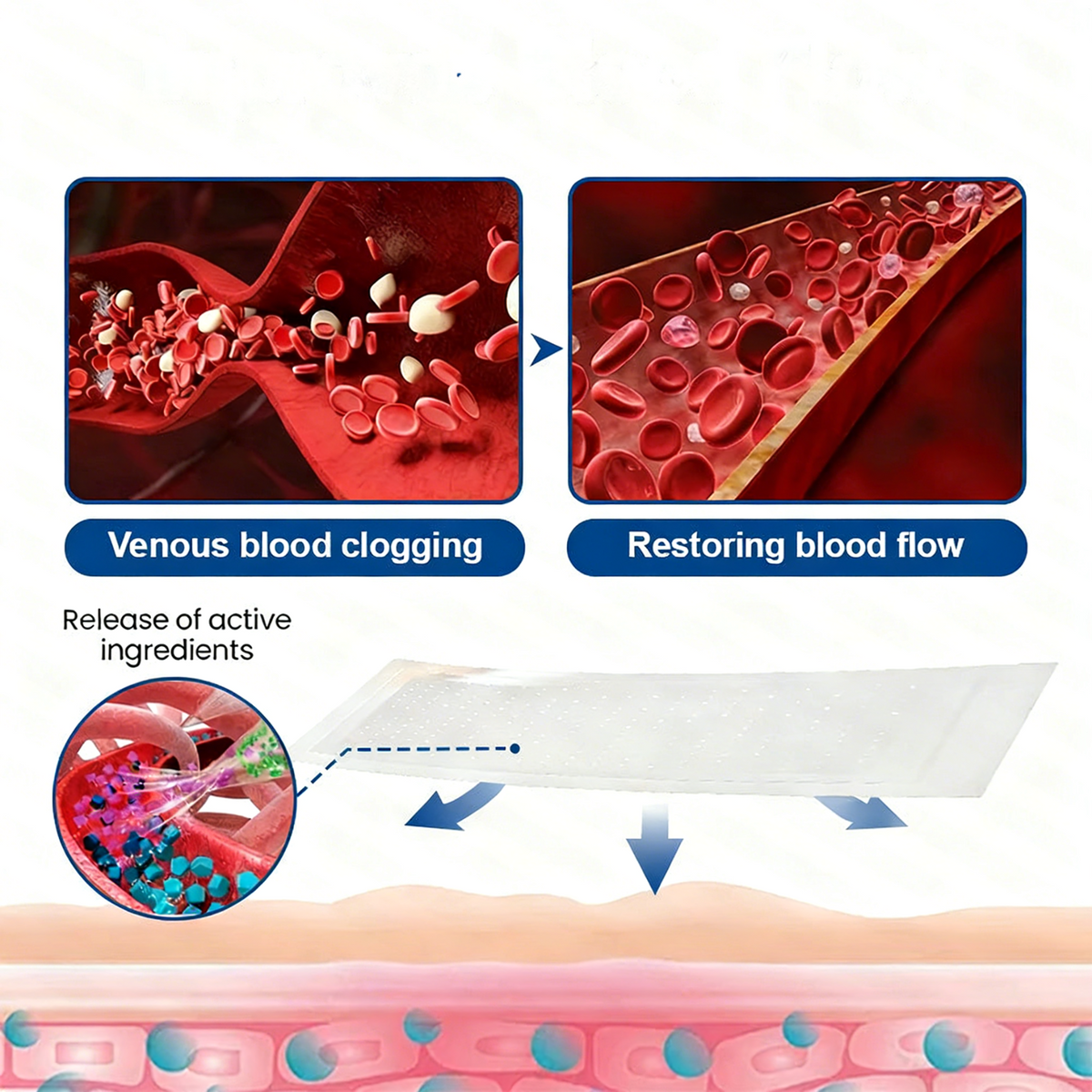 Vein ContourMicroneedle Patch with AdvancedDiosmin & Hesperidin Delivery 🌿 7-Day Visible Results for VaricoseVeins
